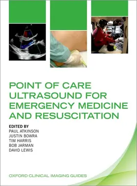 Atkinson / Bowra / Harris |  Point of Care Ultrasound for Emergency Medicine and Resuscitation | Buch |  Sack Fachmedien