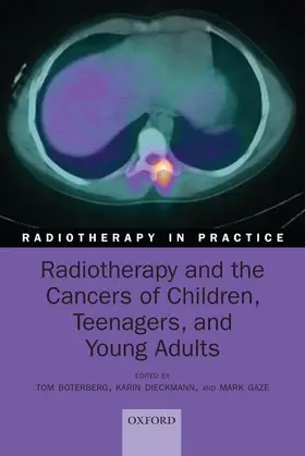 Boterberg / Dieckmann / Gaze | Radiotherapy and the Cancers of Children, Teenagers and Young Adults | Buch | 978-0-19-879307-6 | sack.de