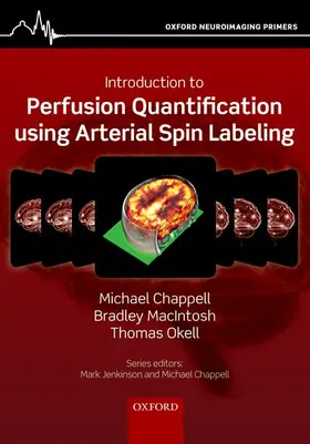 Chappell / MacIntosh / Okell |  Introduction to Perfusion Quantification using Arterial Spin Labelling | Buch |  Sack Fachmedien