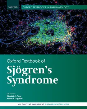 Price / Tappuni |  OT Sjogrens Syndrome C | Buch |  Sack Fachmedien