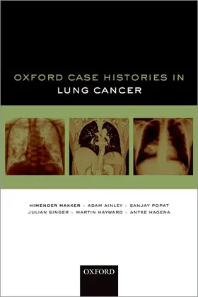 Makker / Ainley / Popat |  Oxford Case Histories in Lung Cancer | Buch |  Sack Fachmedien