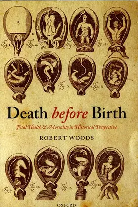 Woods |  Death before Birth | Buch |  Sack Fachmedien