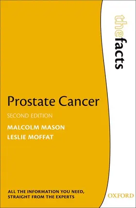 Mason / Moffat | Prostate Cancer | Buch | 978-0-19-957393-6 | www2.sack.de