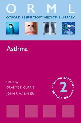 Currie / Baker |  Asthma (Revised) | Buch |  Sack Fachmedien