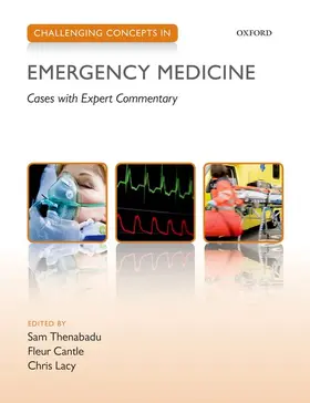 Cantle / Thenabadu / Lacy | Challenging Concepts in Emergency Medicine | Buch | 978-0-19-965409-3 | www2.sack.de