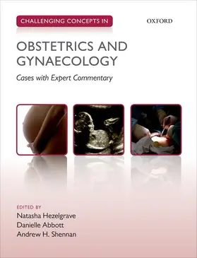 Hezelgrave / Abbott / Shennan | Challenging Concepts in Obstetrics and Gynaecology | Buch | 978-0-19-965499-4 | sack.de