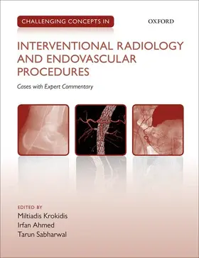 Krokidis / Ahmed / Sabharwal |  Challenging Concepts in Interventional Radiology | Buch |  Sack Fachmedien