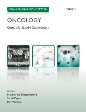Bhattacharyya / Payne / McNeish | Challenging Concepts in Oncology | Buch | 978-0-19-968888-3 | www2.sack.de