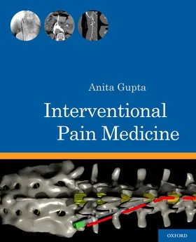 Gupta |  Interventional Pain Medicine | Buch |  Sack Fachmedien