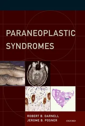 Darnell / Posner |  Paraneoplastic Syndromes | Buch |  Sack Fachmedien