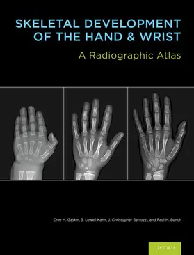 Gaskin / Kahn / Bertozzi |  SKEL DEVELOP HAND & WRIST BK & DVD PCK | Buch |  Sack Fachmedien