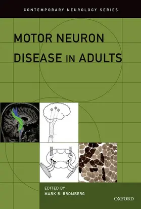 Bromberg |  Motor Neuron Disease in Adults | Buch |  Sack Fachmedien