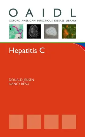 Jensen / Reau |  Hepatitis C | Buch |  Sack Fachmedien