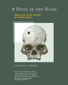 Gross |  A Hole in the Head | Buch |  Sack Fachmedien