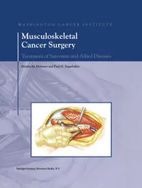 Malawer / Sugarbaker | Musculoskeletal Cancer Surgery | E-Book | sack.de