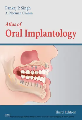 Singh DDS / Singh / Cranin DDS |  Atlas of Oral Implantology - E-Book | eBook | Sack Fachmedien