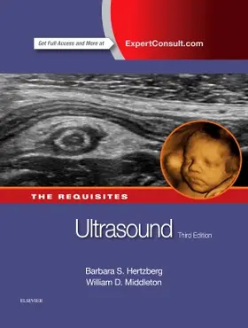 Hertzberg / Middleton |  Ultrasound: The Requisites | Buch |  Sack Fachmedien