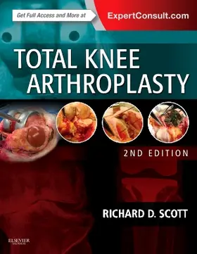 Scott |  Total Knee Arthroplasty | Buch |  Sack Fachmedien