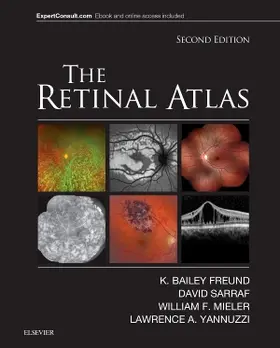 Freund / Sarraf / Mieler |  The Retinal Atlas | Buch |  Sack Fachmedien