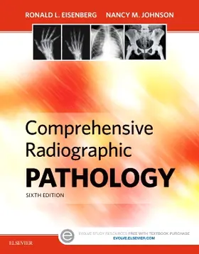 Eisenberg / Johnson |  Comprehensive Radiographic Pathology | Buch |  Sack Fachmedien