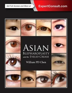 Chen |  Asian Blepharoplasty and the Eyelid Crease | Buch |  Sack Fachmedien