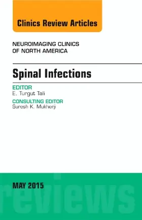 Tali |  Spinal Infections, an Issue of Neuroimaging Clinics | Buch |  Sack Fachmedien