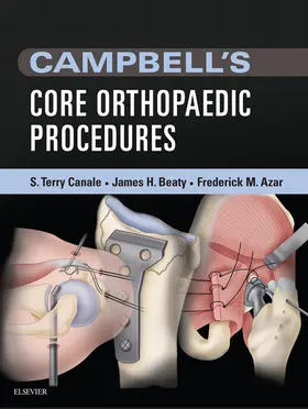 Canale MD / Beaty MD / Azar MD |  Campbell's Core Orthopaedic Procedures E-Book | eBook | Sack Fachmedien