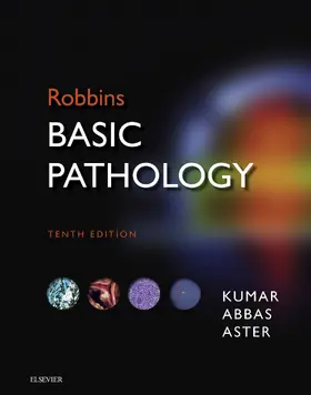 Kumar MBBS / Kumar / Abbas MBBS |  Robbins Basic Pathology E-Book | eBook | Sack Fachmedien