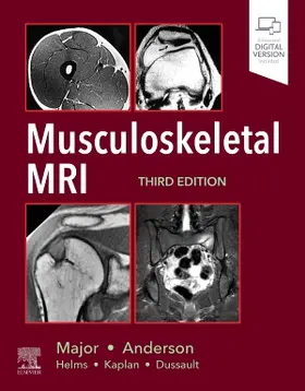 Major / Anderson |  Musculoskeletal MRI | Buch |  Sack Fachmedien