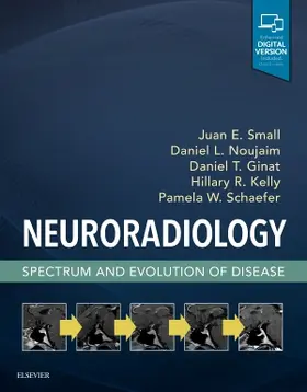 Small / Noujaim / Ginat |  Neuroradiology: Spectrum and Evolution of Disease | Buch |  Sack Fachmedien