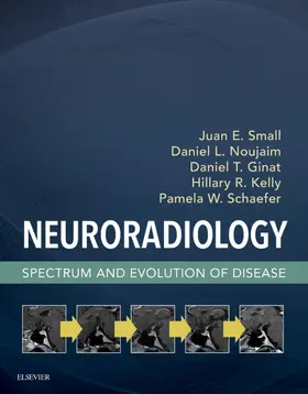 Small MD / Noujaim MD / Kelly MD |  Neuroradiology | eBook | Sack Fachmedien