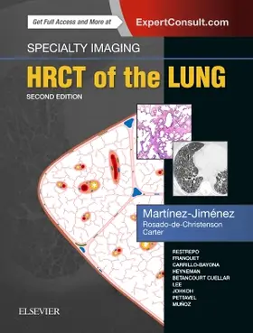 Martínez-Jiménez / Rosado-de-Christenson / Carter |  Specialty Imaging: Hrct of the Lung | Buch |  Sack Fachmedien