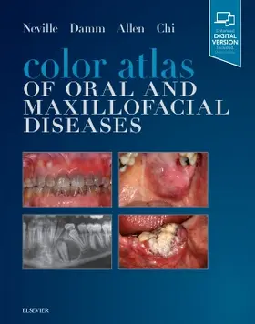 Neville / Damm / Allen |  Color Atlas of Oral and Maxillofacial Diseases | Buch |  Sack Fachmedien