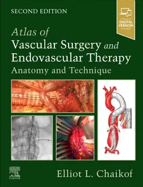 Chaikof |  Atlas of Vascular Surgery and Endovascular Therapy | Buch |  Sack Fachmedien