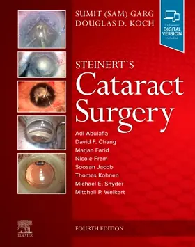 Garg / Koch |  Steinert's Cataract Surgery | Buch |  Sack Fachmedien