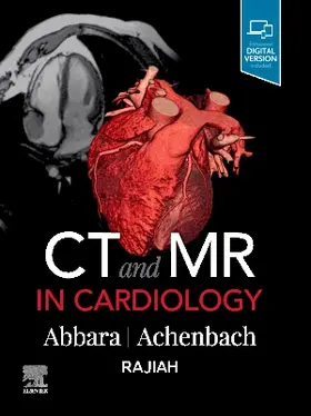 Abbara / Achenbach |  CT and MR in Cardiology | Buch |  Sack Fachmedien