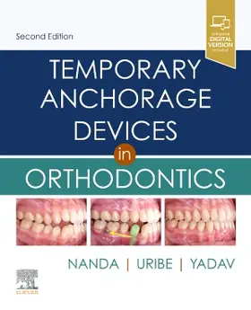 Nanda / Uribe / Yadav | Temporary Anchorage Devices in Orthodontics | Buch | 978-0-323-60933-3 | sack.de