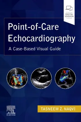 Naqvi |  Point-Of-Care Echocardiography | Buch |  Sack Fachmedien