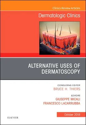 Micali / Lacarrubba |  Alternative Uses of Dermatoscopy, an Issue of Dermatologic Clinics | Buch |  Sack Fachmedien