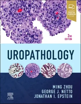 Zhou / Netto / Epstein |  Uropathology | Buch |  Sack Fachmedien