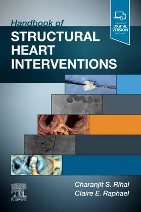 Rihal / Raphael |  Handbook of Structural Heart Interventions | Buch |  Sack Fachmedien