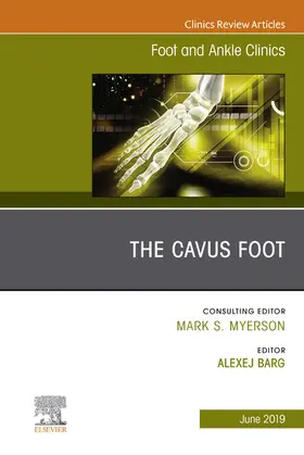 Barg |  The Cavus Foot, An issue of Foot and Ankle Clinics of North America | eBook | Sack Fachmedien