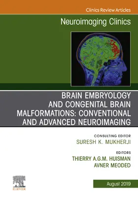 Meoded |  Brain Embryology and the Cause of Congenital Malformations, An Issue of Neuroimaging Clinics of North America, ebook | eBook | Sack Fachmedien