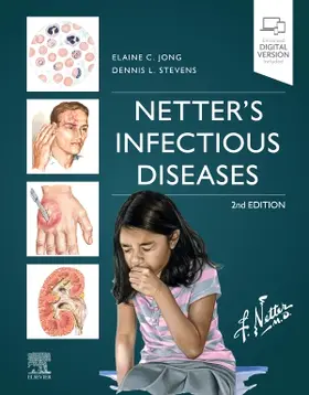 Stevens / Jong | Netter's Infectious Diseases | Buch | 978-0-323-71159-3 | www2.sack.de