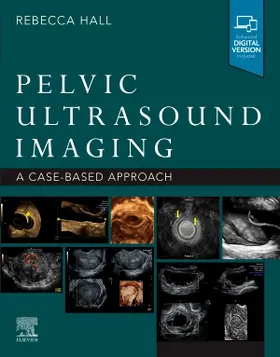 Hall |  Pelvic Ultrasound Imaging | Buch |  Sack Fachmedien