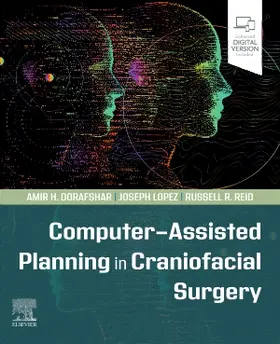 Dorafshar / Lopez / Reid |  Computer-Assisted Planning in Craniofacial Surgery | Buch |  Sack Fachmedien