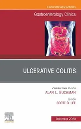 Lee MD / Lee |  Ulcerative Colitis, An Issue of Gastroenterology Clinics of North America, E-Book | eBook | Sack Fachmedien