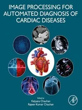 Chauhan | Image Processing for Automated Diagnosis of Cardiac Diseases | E-Book | www2.sack.de