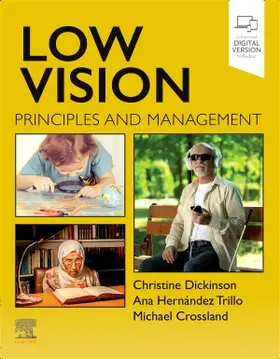 Hernandez Trillo / Dickinson / Crossland |  Low Vision | Buch |  Sack Fachmedien