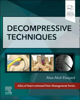 Abd-Elsayed |  Decompressive Techniques | Buch |  Sack Fachmedien